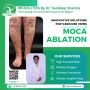 Advanced Varicose Veins Treatment in India by Top Specialist