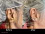How Long Does It Take for Ear Piercings to Heal? A Complete 