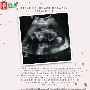  Fetal echocardiography treatment
