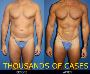 Enhance Your Look with Plastic Surgery for Men