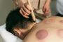 Acupuncture Services in Dupont Circle, Washington DC