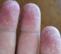 Effective Foot Care: Remove Dead Skin with FootDefend Produc