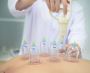 Best Cupping treatment in Soho