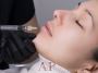 Best Russian Lips Fillers in Sale