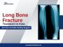 Long Bone Fracture Treatment in Kota – Advanced Orthopedic 