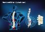 Advanced PIVD Treatment in Kota by Expert PIVD Specialist