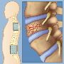 Kota’s Leading Spine Injury Treatment Center | Expert Spine 