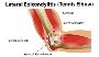 Orthopedic Doctor for Tennis Elbow in Kota 