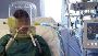 Disadvantages of opting for invasive ventilation