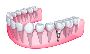 Infinite Smiles Dental, Bolingbrook, IL – Smile with happine
