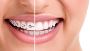 Dental Aesthetics and Wellness Center - Affordable Cosmetic 