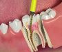 My Dental Home - Best quality dental work that Swartz Creek 