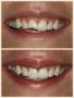 Emergency Dentist in Peoria, Arizona | Alpha Dental!