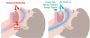 Effective Sleep Disorder Treatment at Clarity Dental