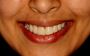 Invisalign Winnipeg – Straighter Smiles with Clarity Dental