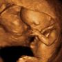 Looking For the Ideal Diagnostic Center For 4D Ultrasound