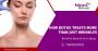 Botox Treatment Surgery in Jaipur- Kalpana Aesthetics