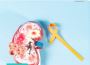 Kidney Specialist in Delhi Kidney Specialist in Delhi