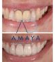 Best Dental Clinic in Bangalore | Top Dentist Bangalore