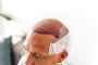 Important Considerations to Choose a Reputable Clinic for Ha