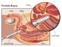 Best Urology Near Me – Kapoor's Kidney & Urostone Centre