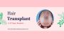 Hair Transplant in JP Nagar