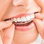 kliniek haartransplantatie | Kliniekvergelijker.nl