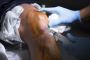 Expert Meniscal Injury Surgery in Manchester – Regain Pain-F