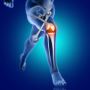 Staffordshire Knee Surgeon – The Knee Clinic Manchester