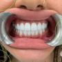 Trusted Merrylands Dentist | Quality Dental Care for Your Sm