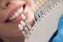 Merrylands Dentist: Quality Dental Services from Preventive 