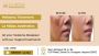 Melasma Treatment in Gurgaon: La Midas Aesthetics