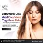 Anti-Aging Solutions in Darbhanga | Stay Youthful with Laser
