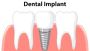 Oral Health Gum Care Bethlehem | Dentist Bethlehem