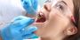 Tooth Colored Fillings Bethlehem | Teeth Whitening Bethlehem