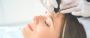 Exosomes Facial Rejuvenation Treatment in London