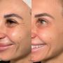 Skin Clinic Berwick