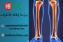 What can I expect during recovery from limb lengthening surg