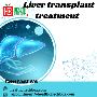 Step-by-Step Guide to Post-Liver Transplant Care