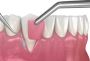 Find a Periodontal Dentist in Rockwall, Texas