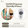 Get Rid Of Lipomas Naturally At Home