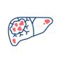 Best Liver Cancer Treatment Hospitals in Hyderabad
