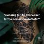 Safe & Effective Laser Tattoo Removal in Kolkata