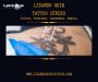 Best Laser Tattoo Removal Clinic in Kolkata for Safe & Scar