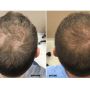 Top Pediatric Hair Dermatologist at London Dermatology Clini