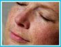 Dermatologist Harley Street London – Expert Care at London D