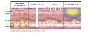 How Does Ultherapy Tighten Skin on Face ?.