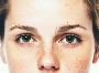 4 Easy Pigmentation Treatment in Singapore