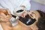 Is chemical peeling good for skin?