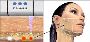 5 Common Myths About Ultherapy Debunked